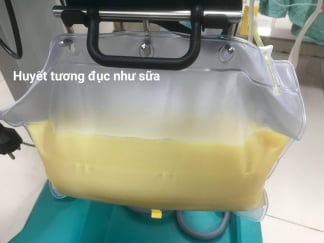 Bệnh nhân viêm tụy cấp có huyết tương trắng như sữa cực kỳ nguy hiểm